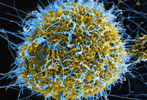 Ebola Patient’s Condition Worsens – NCDC